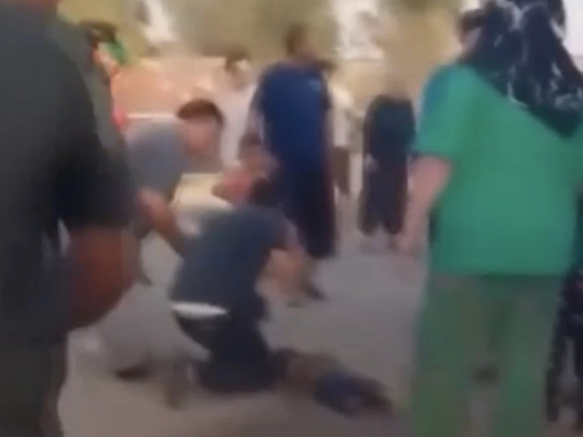 Konteyner Kentte Dehşet: Yangında Ağır Yaralanan Çocuk Hayatını Kaybetti